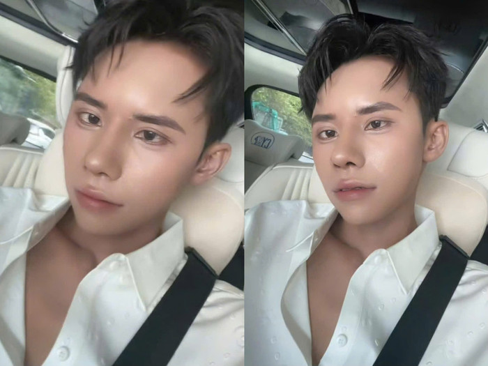 Diện mạo của Lai Thai 'lên hương' đáng kể sau lần phẫu thuật thẩm mỹ đầu tiên. (Ảnh chụp màn hình)