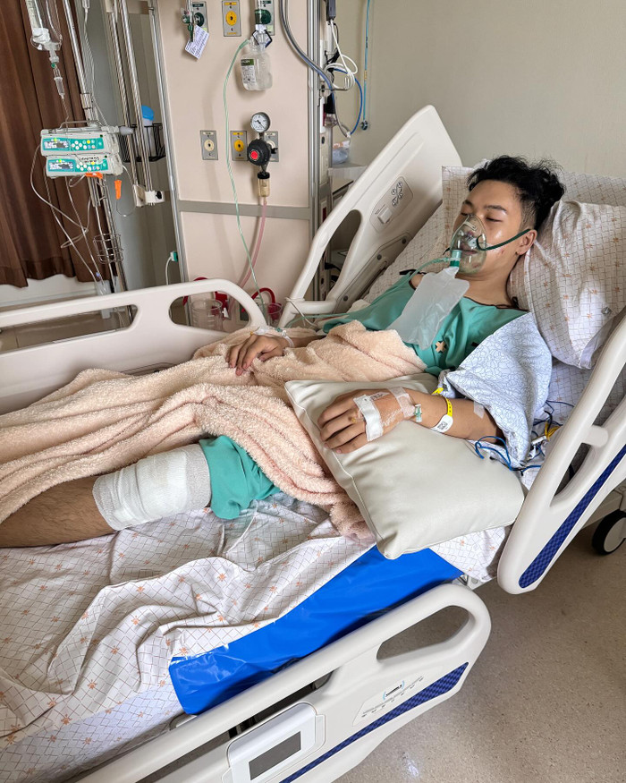Nam ca sĩ bị tai nạn xe máy gãy mũi, nứt răng khiến khán giả bàng hoàng Ảnh 1