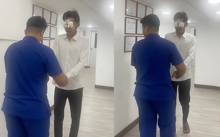 Lai Thai thẩm mỹ đôi mắt, điểm từng khiến anh bị chọc ghẹo. (Ảnh chụp màn hình)